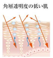 角質透明度の低い肌